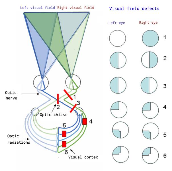 visual-fields.jpg visual-fields.jpg